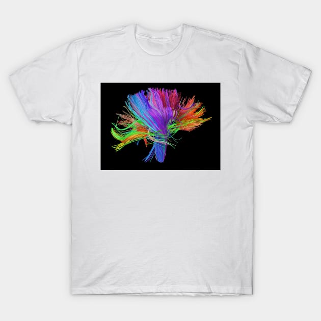 White matter fibres of the human brain (C023/9414) T-Shirt by SciencePhoto